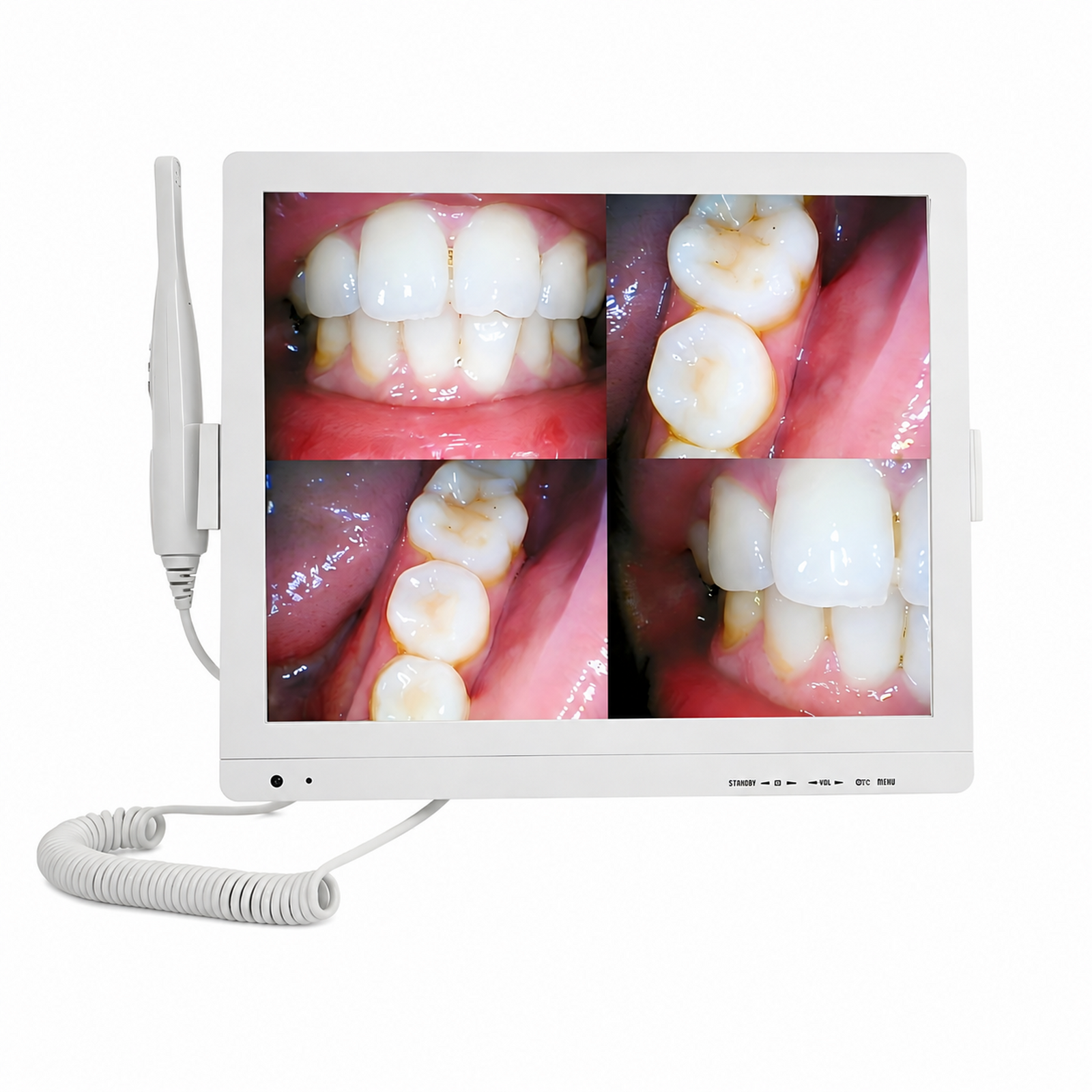 17 inch dental intraoral camera KL-A6W-X