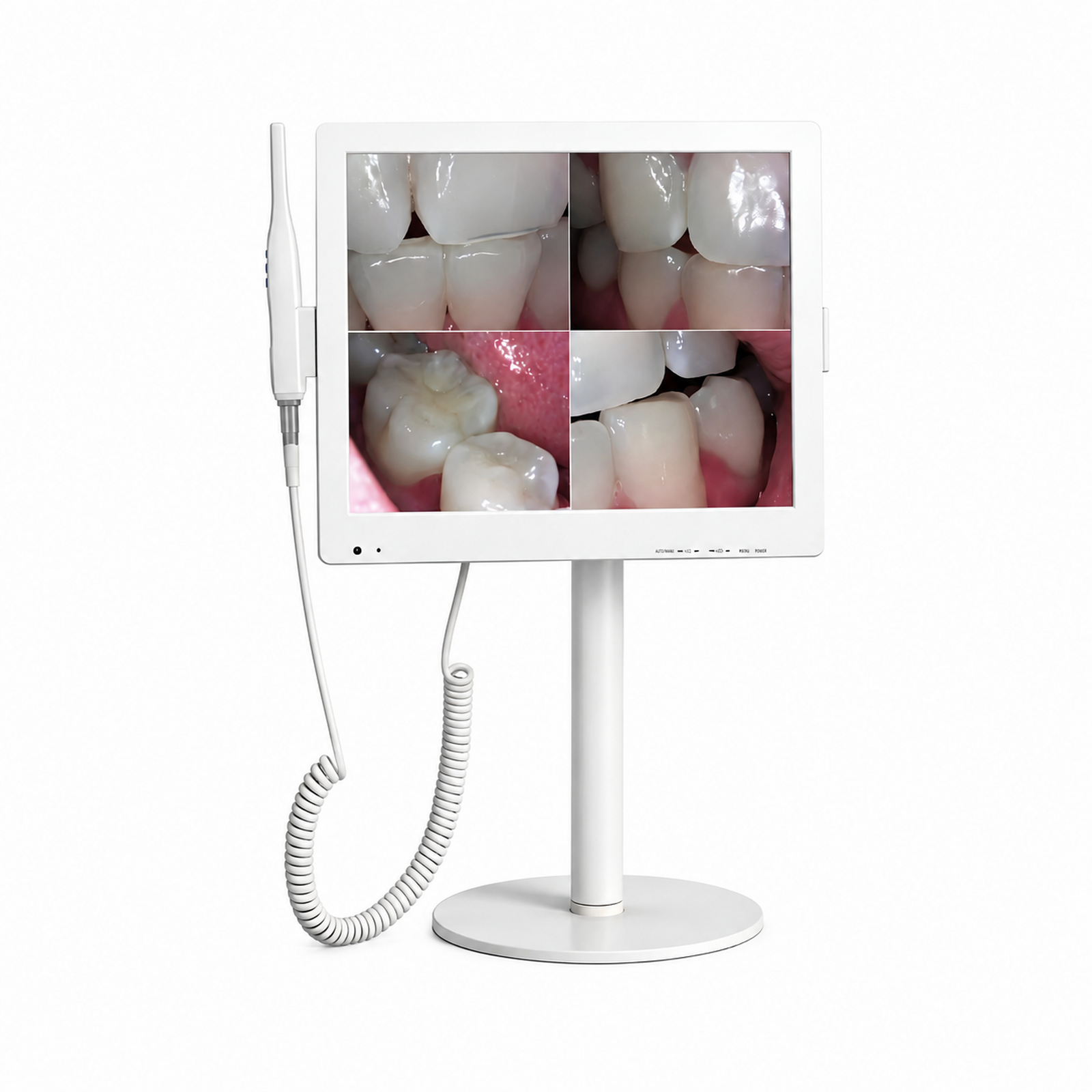 17 inch dental intraoral camera KL-A6W-X