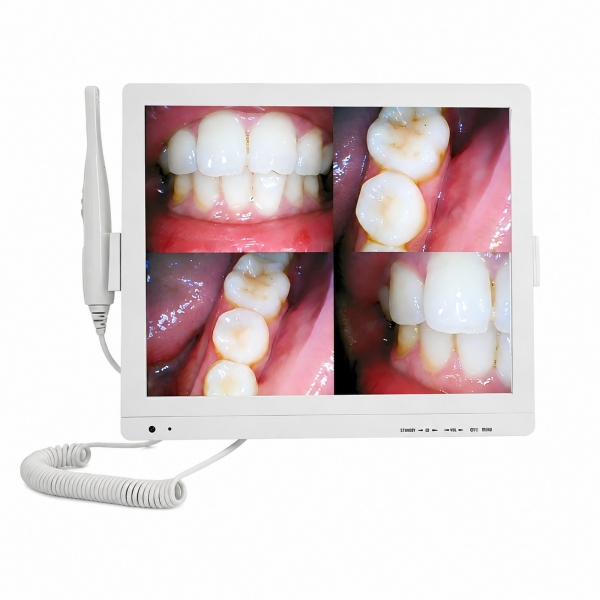 17 inch dental intraoral camera KL-A6W-X